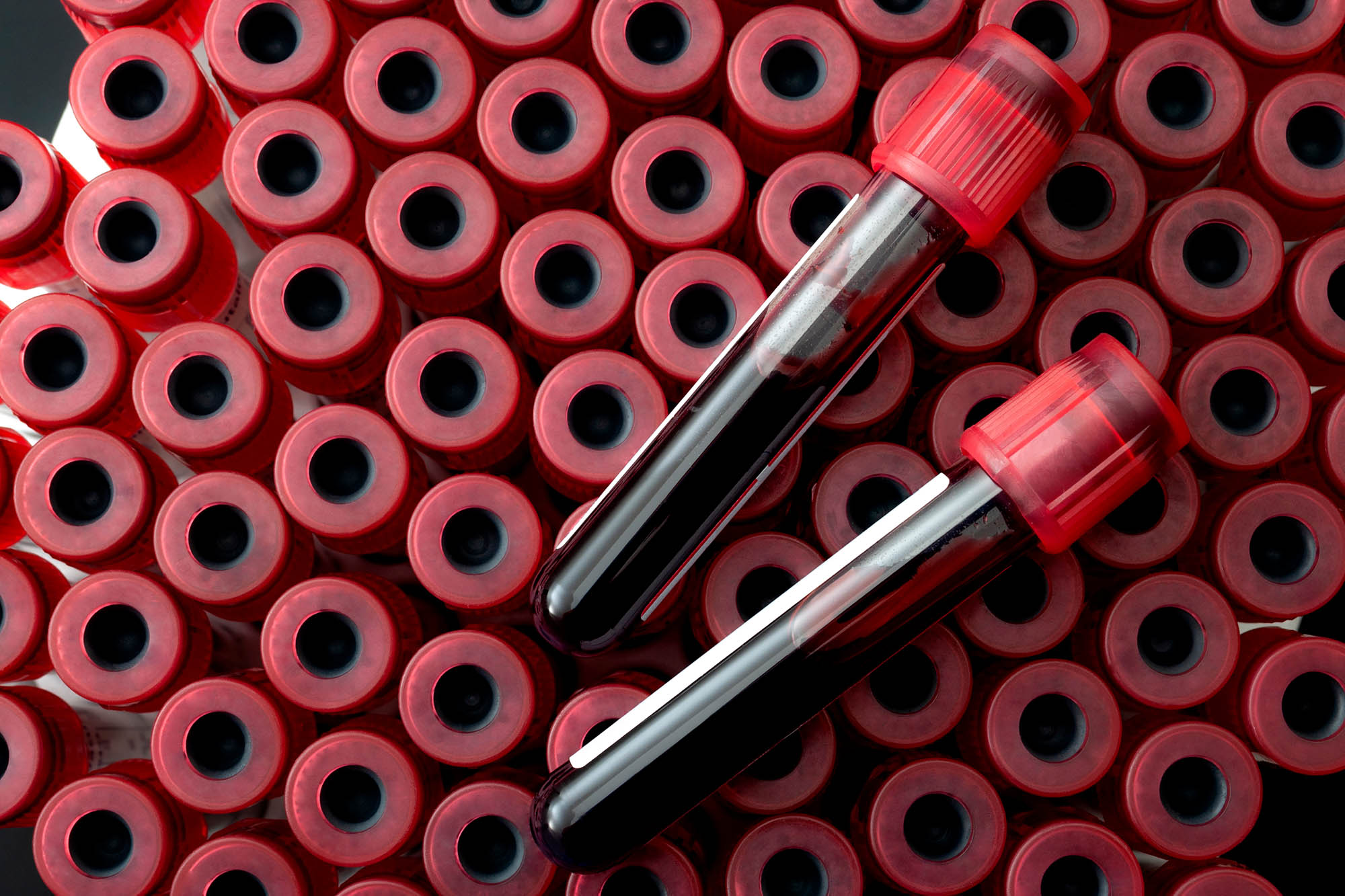 photo of vials of blood Phlebotomy